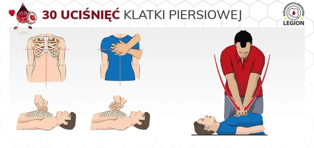 Pierwsza pomoc ile ucisków: Kluczowe zasady skutecznej resuscytacji