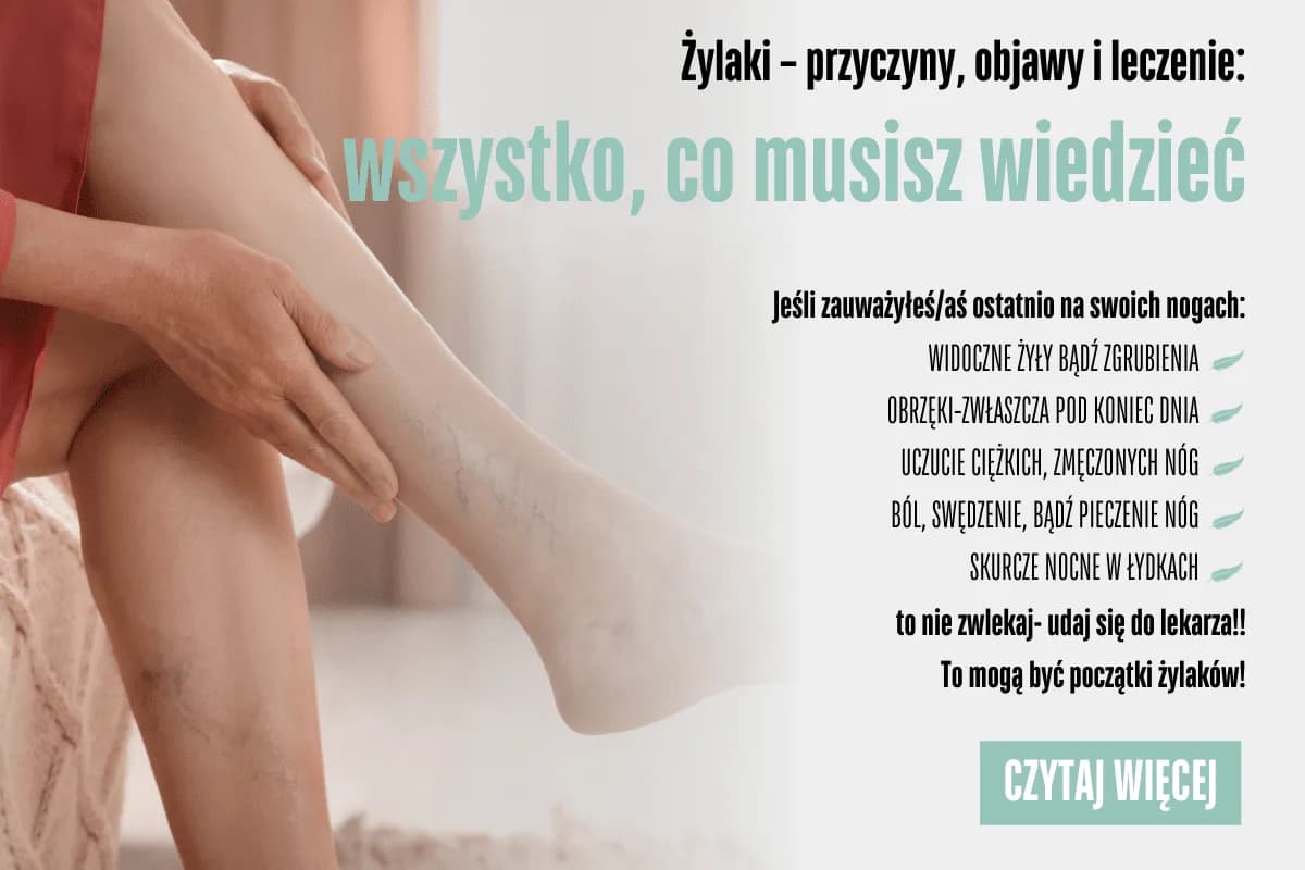 Skuteczne leki na żylaki - jak uniknąć bólu i poprawić krążenie
