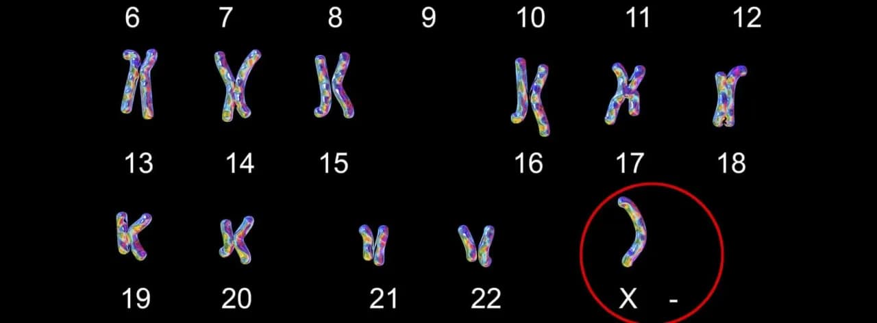 Zespół Turnera objawy – poznaj niepokojące symptomy tej choroby