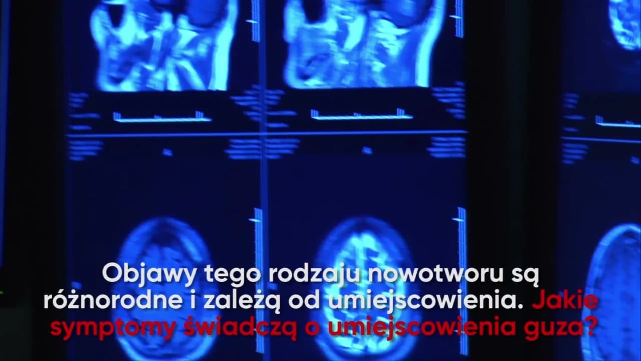 Jakie są objawy guza mózgu? Nie ignoruj tych niepokojących sygnałów